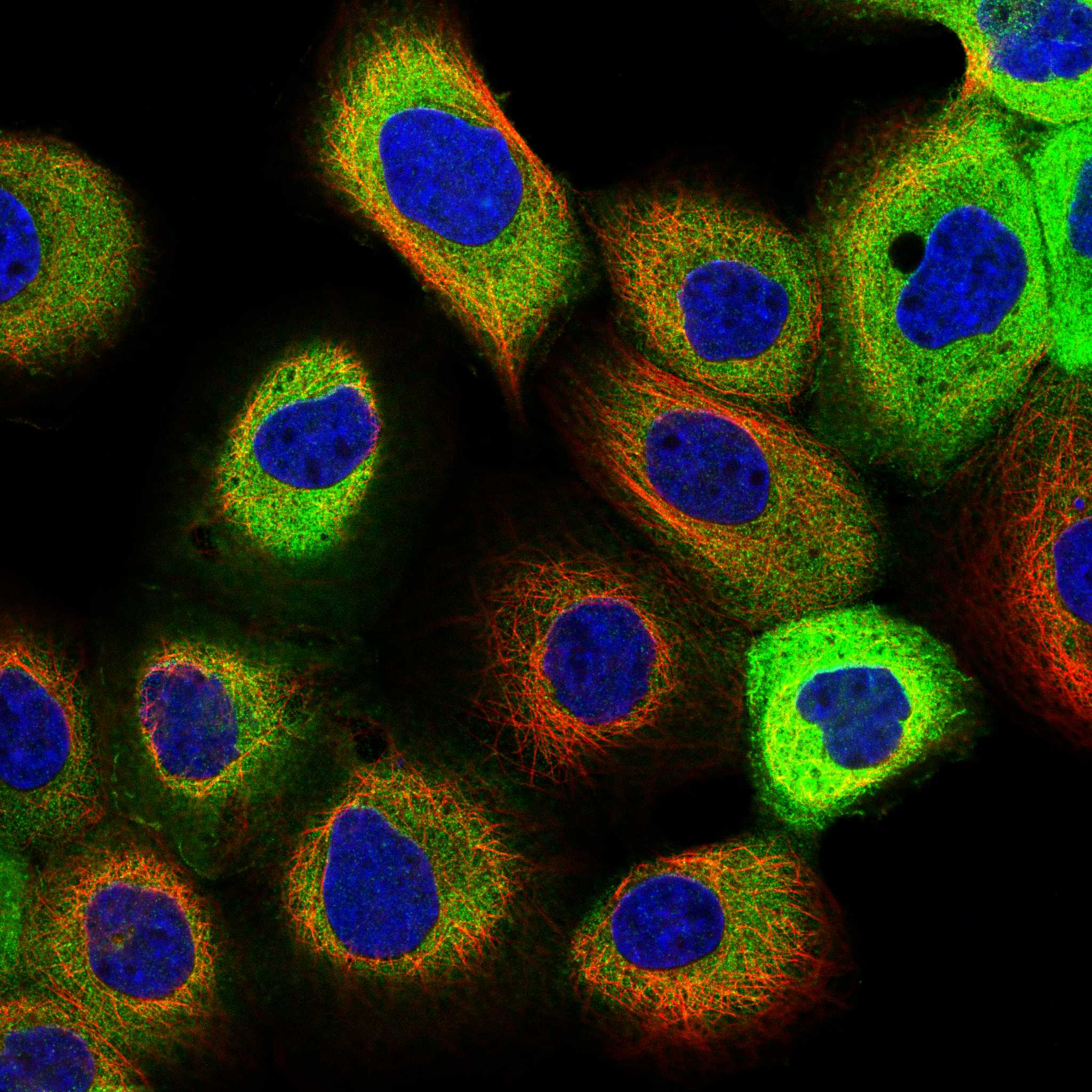 Subcellular CAMKK1 The Human Protein Atlas