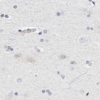 HPA IHC Cerebral cortex — THEM4