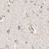 HPA IHC Cerebral cortex — SASS6