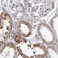 HPA IHC Kidney — CPT2