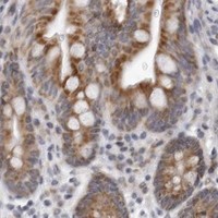 HPA IHC Colon — CPT2