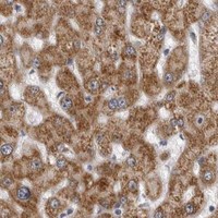 HPA IHC Liver — CPT2
