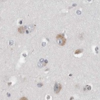 HPA IHC Cerebral cortex — CPT2