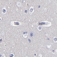 HPA IHC Cerebral cortex — TM4SF1