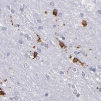 HPA IHC Cerebral cortex — PTGS1