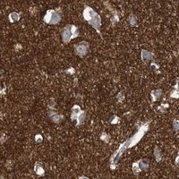 HPA IHC Cerebral cortex — EPHA4