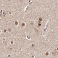 HPA IHC Cerebral cortex — MED8