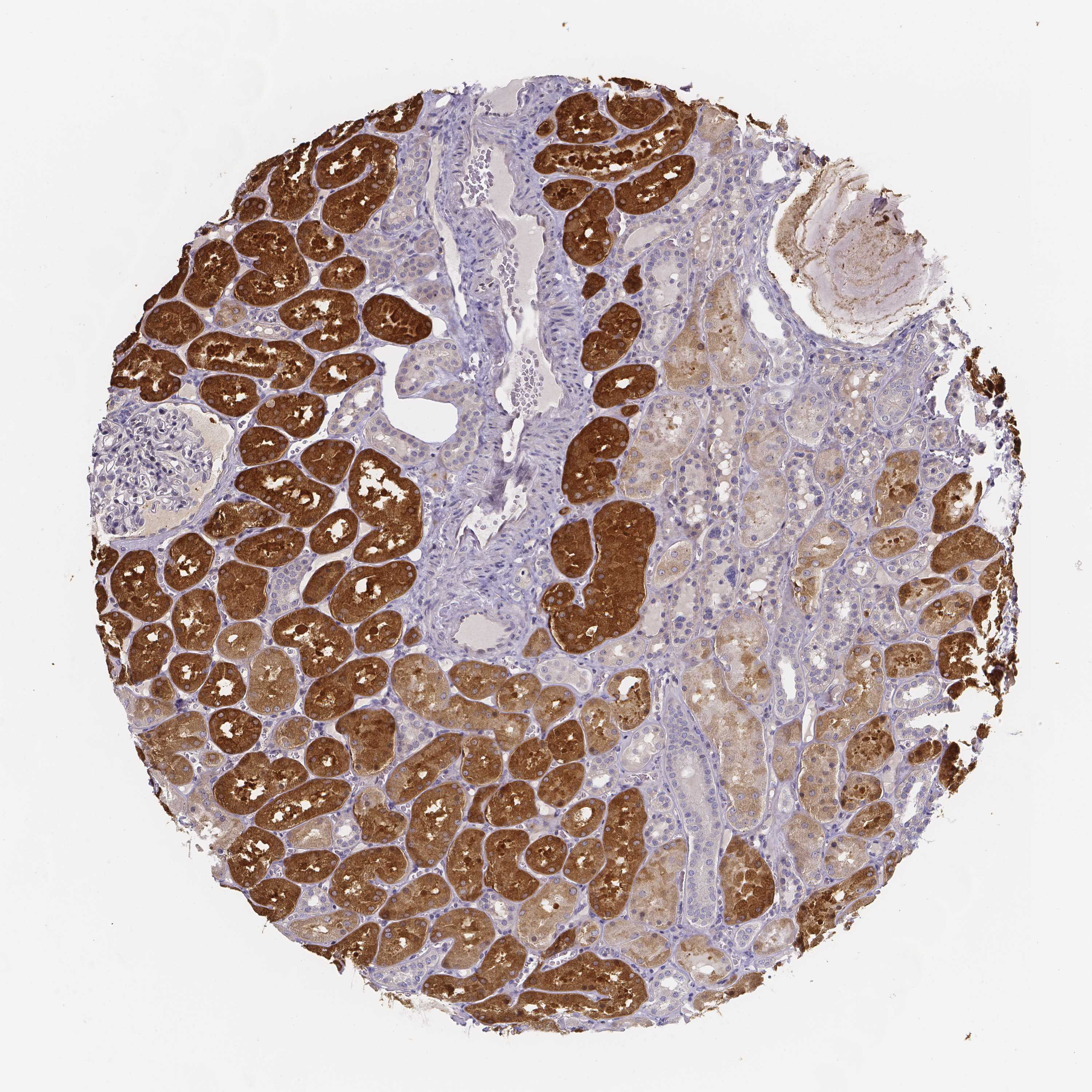 Tissue expression of PAH Staining in kidney The Human Protein Atlas