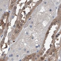 HPA IHC Kidney — HSPA6