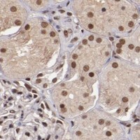 HPA IHC Kidney — STAG2