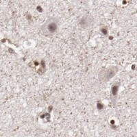 HPA IHC Cerebral cortex — STAG2