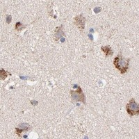 HPA IHC Cerebral cortex — SSBP1