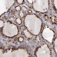 HPA IHC Thyroid gland — HCAR2