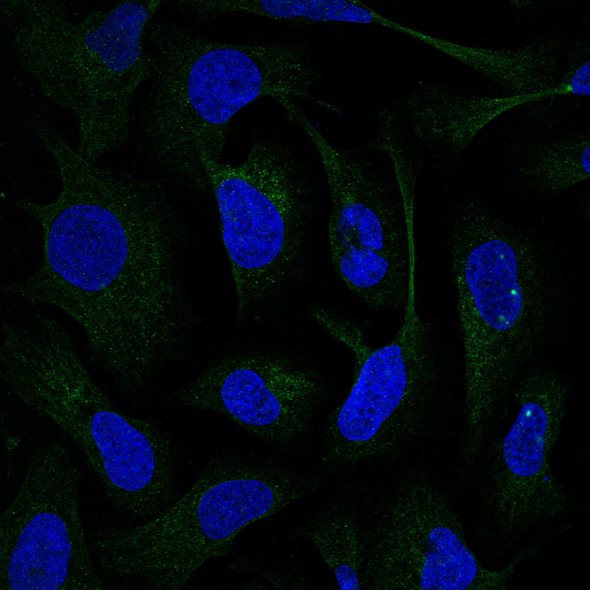 Subcellular MTARC1 The Human Protein Atlas