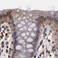 HPA IHC Colon — AKT1
