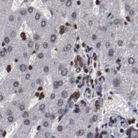 HPA IHC Liver — AKT1