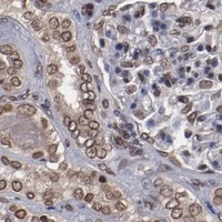 HPA IHC Kidney — AKT1