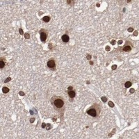 HPA IHC Cerebral cortex — AKT1