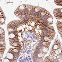HPA IHC Small intestine — SLC2A2
