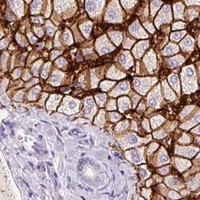 HPA IHC Liver — SLC2A2