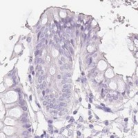 HPA IHC Colon — SLC2A2