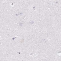 HPA IHC Cerebral cortex — SLC2A2