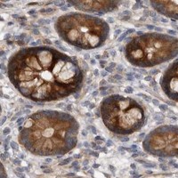 HPA IHC Small intestine — SMYD2