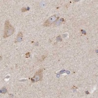 HPA IHC Cerebral cortex — SMYD2