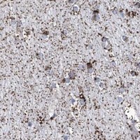 HPA IHC Cerebral cortex — ALDH6A1