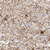 HPA IHC Cerebral cortex — ASCL1