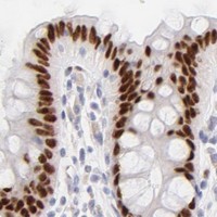 HPA IHC Colon — KLF4