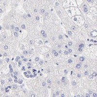 HPA IHC Liver — KLF4