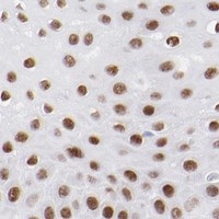 HPA IHC Esophagus — KLF4