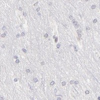 HPA IHC Cerebral cortex — KLF4