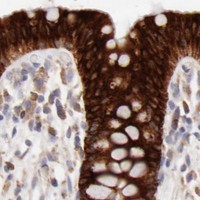 HPA IHC Colon — ENTPD5