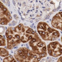 HPA IHC Kidney — ENTPD5