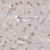 HPA IHC Cerebral cortex — ENTPD5