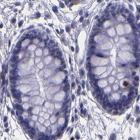 HPA IHC Colon — CEBPE