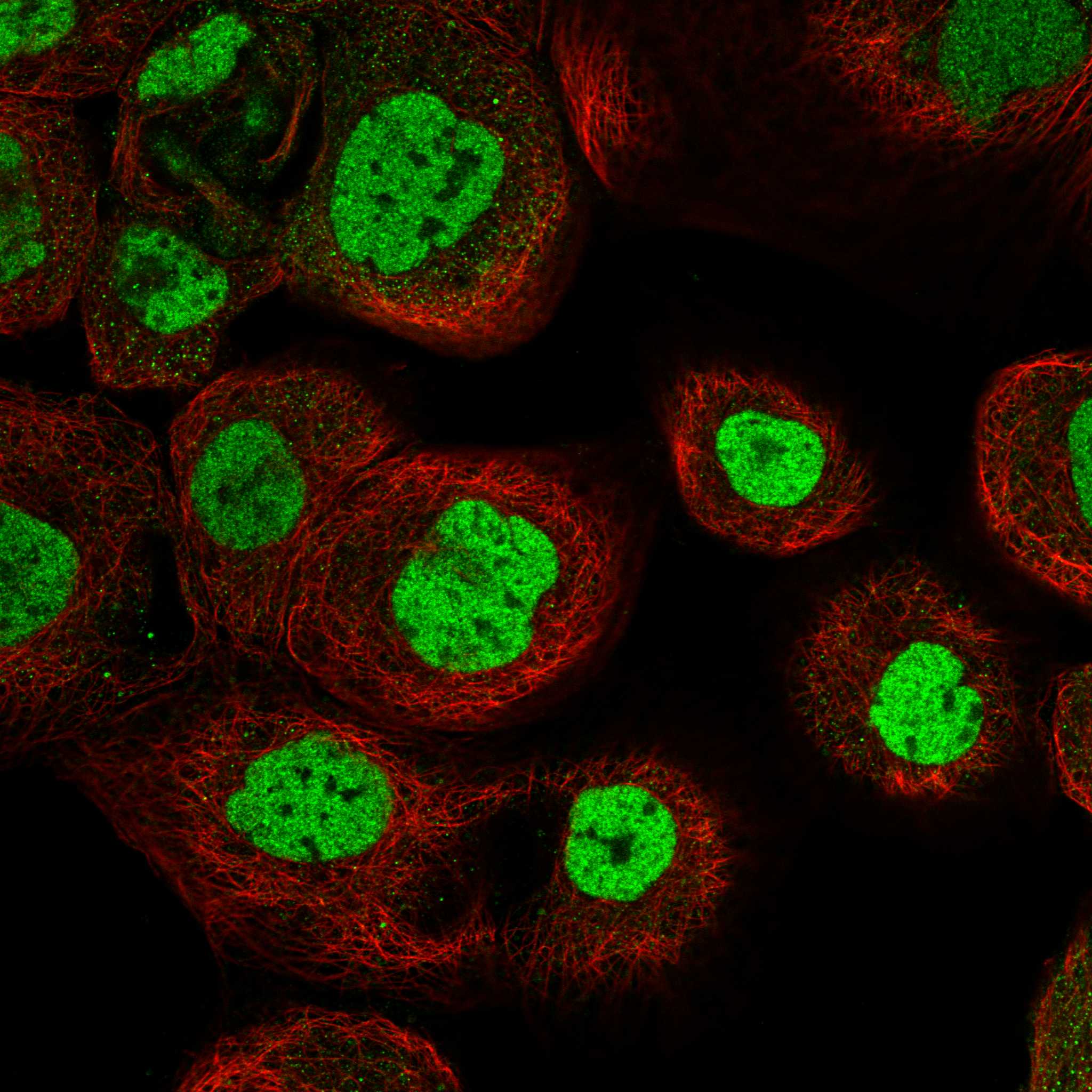 Subcellular SNRNP200 The Human Protein Atlas