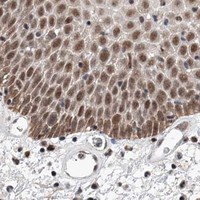 HPA IHC Oral mucosa — SNRNP200