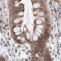 HPA IHC Colon — SNRNP200