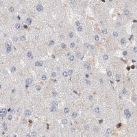 HPA IHC Liver — SNRNP200
