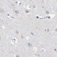HPA IHC Cerebral cortex — SNRNP200