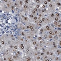 HPA IHC Liver — PIP5K1A
