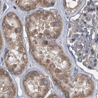 HPA IHC Kidney — PIP5K1A