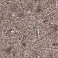 HPA IHC Cerebral cortex — PIP5K1A