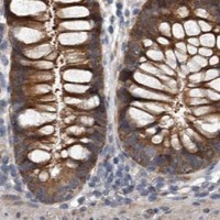 HPA IHC Colon — DHPS