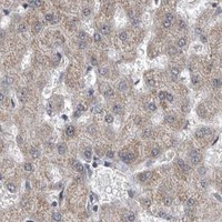 HPA IHC Liver — DHPS