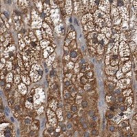 HPA IHC Adrenal gland — DHPS