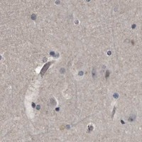 HPA IHC Cerebral cortex — DHPS